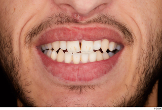 Pablo teeth 0001.jpg